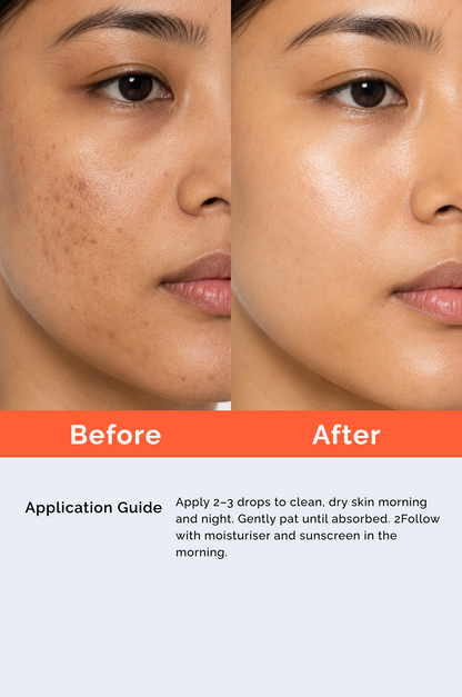 Advanced Complexion Corrector Serum