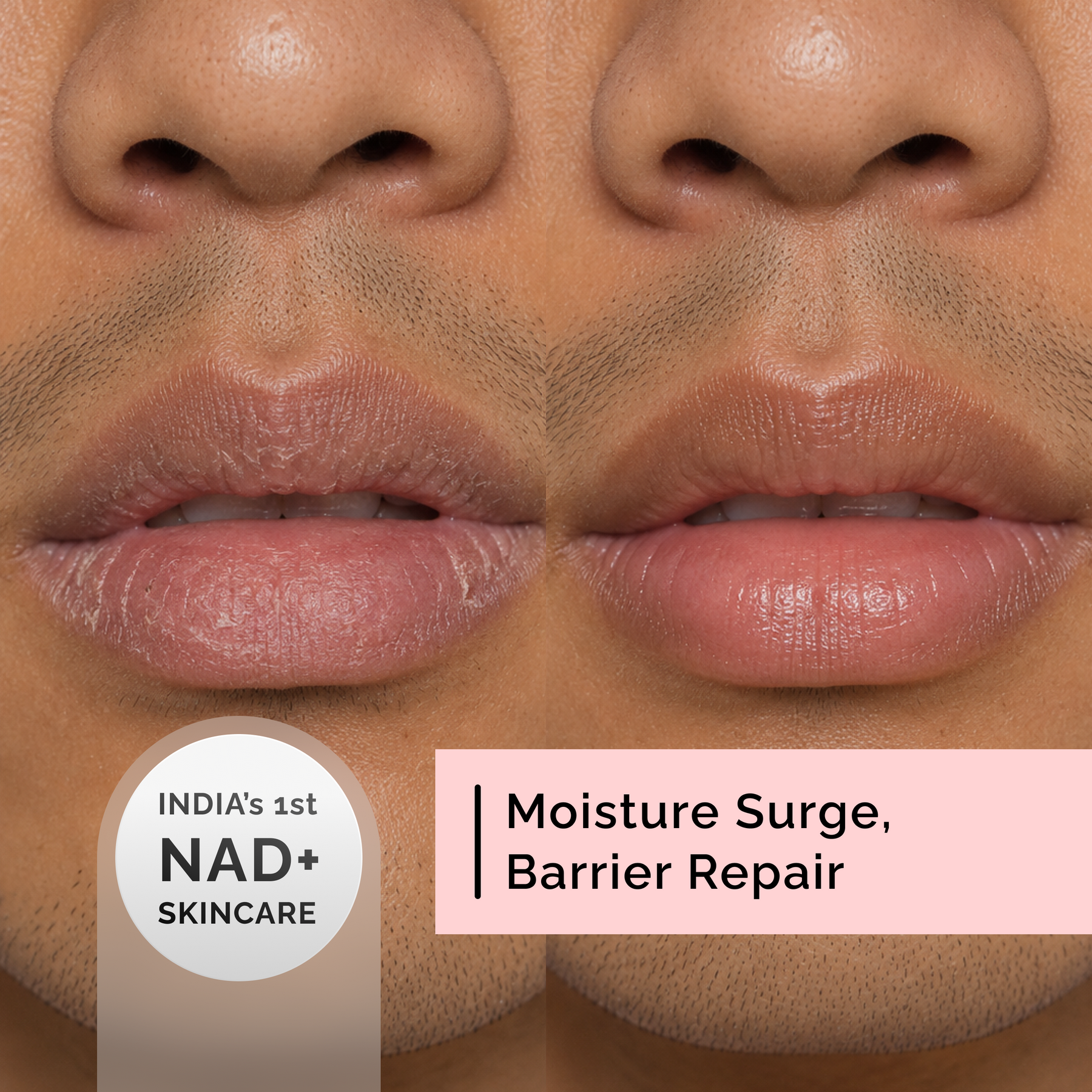 Moisture Surge Lip Butter