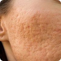 Oxidative Stress & Cellular Repair